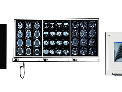 现代医疗器材 检测仪 B超仪器 X光 心电图 医疗设施设备 脑部X光